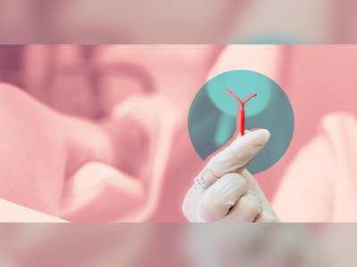 What Is an IUD? Everything You Should Consider Before Choosing This Form of Birth Control