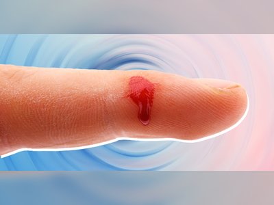 Here's How to Tell if You Have an Infected Cut-And What to Do About It