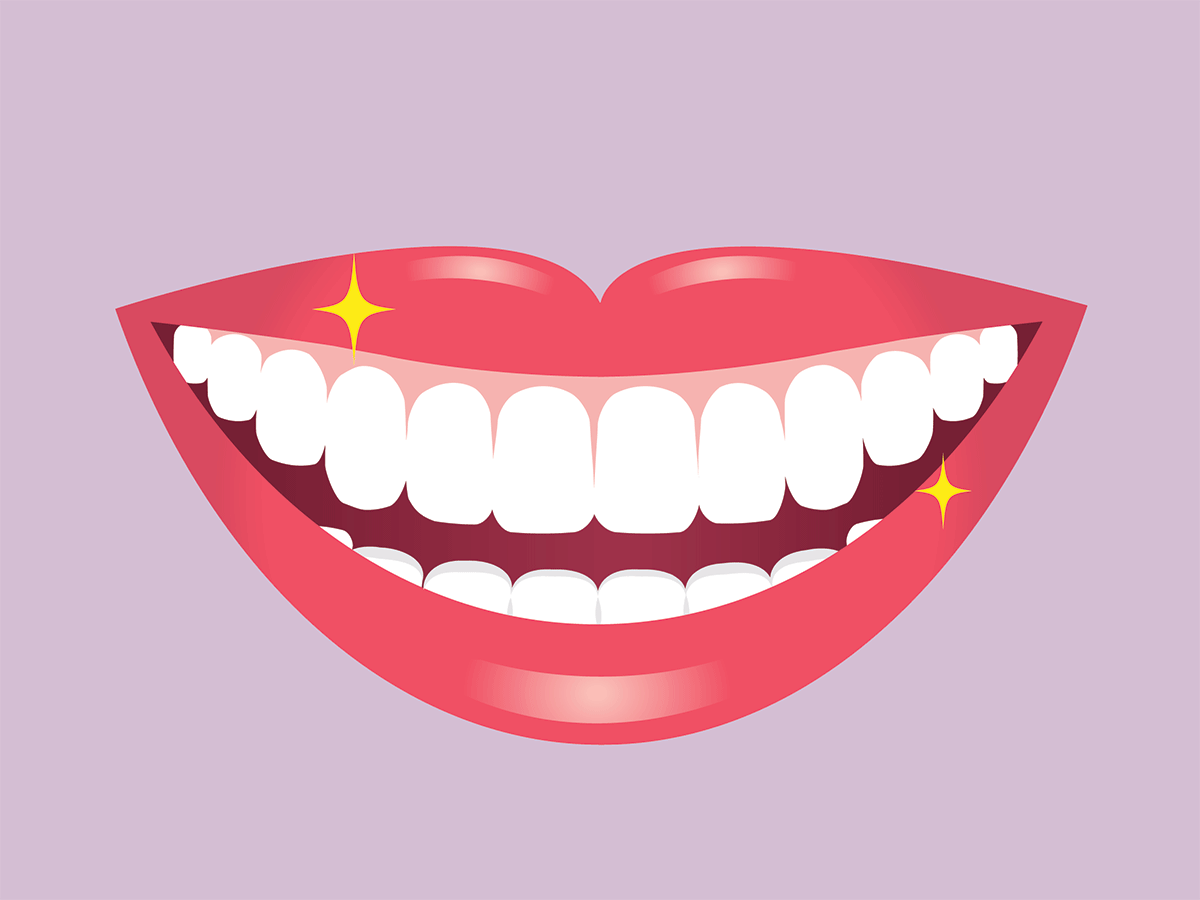 10 Teeth Whitening Mistakes to Avoid