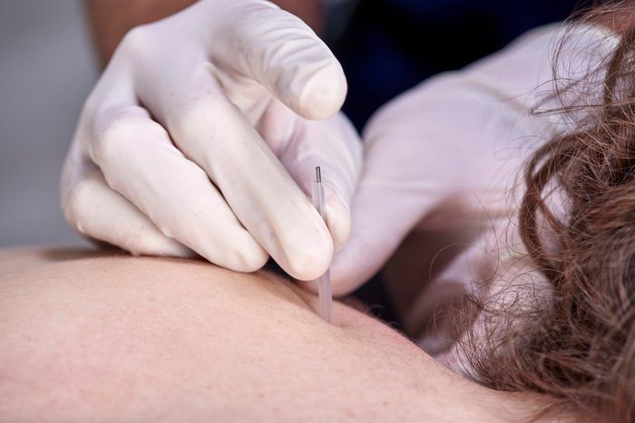Can Trigger Point Injections Treat Your Pain?