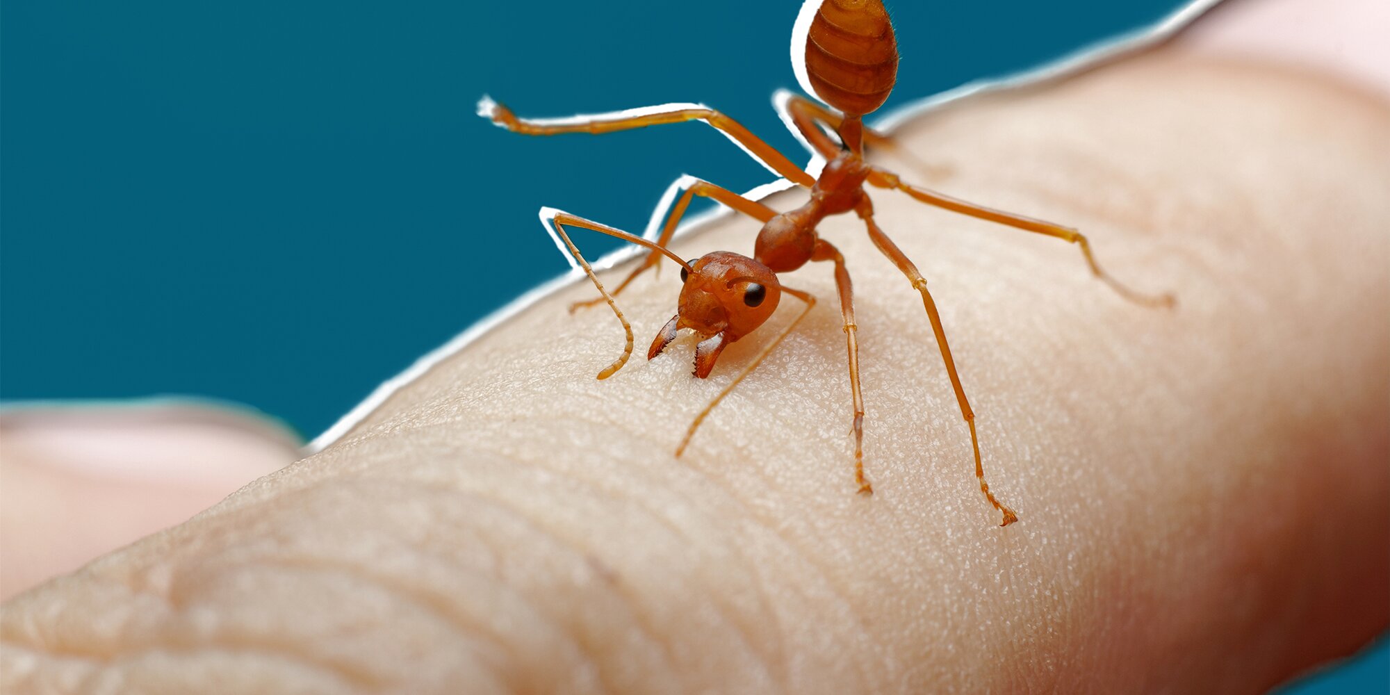 Everything You Need to Know About Ant Bites, According to Experts