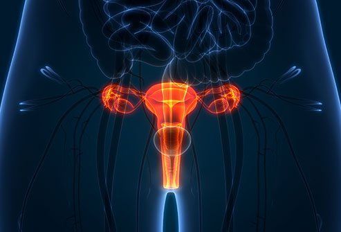 Can You Have a Pelvic Inflammatory Disease Without Having an STD?